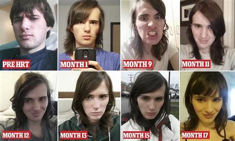Woman Shares Photo Diary Of Transition After 17 Months Of HRT Male To