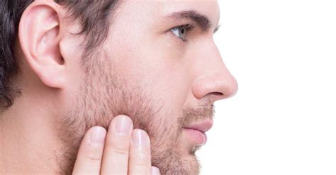 Ultimate Guide On Beard Acne Top 4 Causes Treatment And Prevention