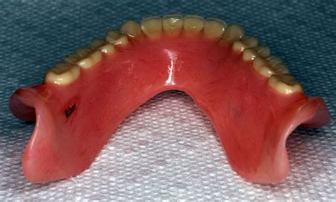 Premium Partial And Full Dentures Straight From The Dentists