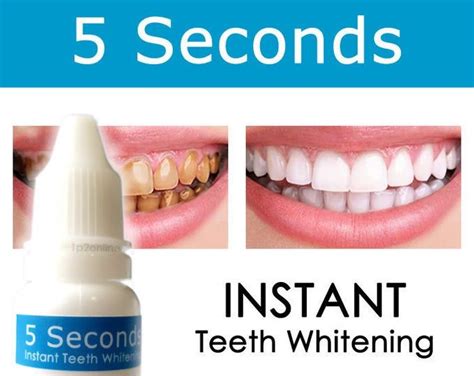 These veneers are fake teeth that snap on over your actual teeth with the goal of improving the these diy dental veneers are still slightly customizable, but faster, cheaper and less effective even. Pin on Veneers teeth