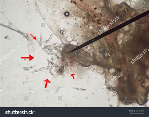 35 Demodex Mites Photos Images Stock Photos And Vectors Shutterstock