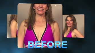 Utah Natural Breast Augmentation Before After Testimonial YouTube