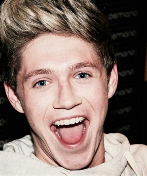 Niall With Braces Niall Horan Pinterest