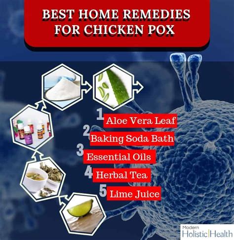 Top 11 Natural Remedies For Chicken Pox Modern Holistic Health