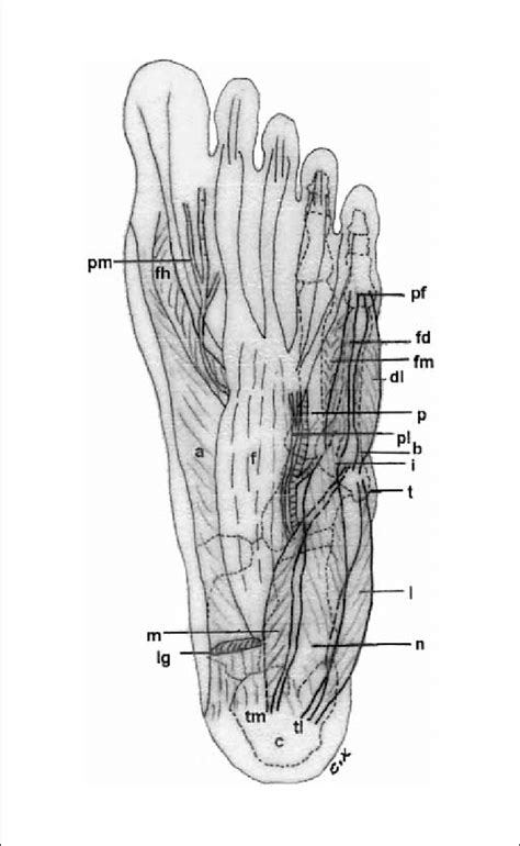 Diagram Of The Sole Of The Left Foot After Resection Of The Plantar