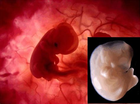 Desarrollo Fetal Temprano Semana 6 Edad Fetal 4 Semanas