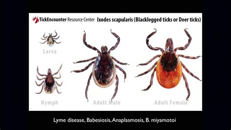 Dr Thomas A Moorcroft Do An Osteopathic Approach To Lyme Disease