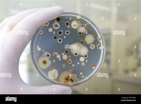 Colonies Of Different Bacteria And Mold Fungi Grown On Petri Dish With