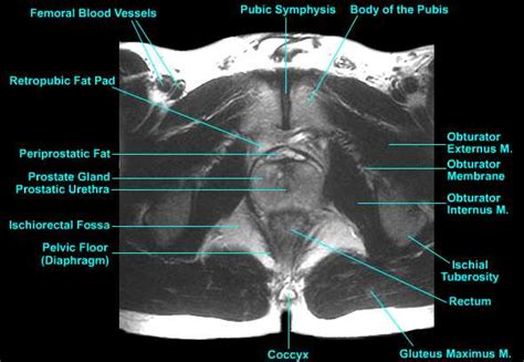 Prostate Imaging