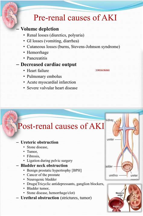 Acute Kidney Injury Stage 1 Treatment Derifit