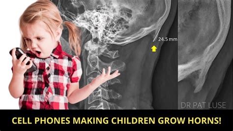 Are Kids Really Growing Horns From Cell Phones Latest Science Theres