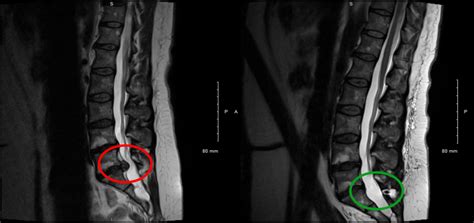 Pathologies de la colonne vertébrale Chirurgie orthopédique traumatologie