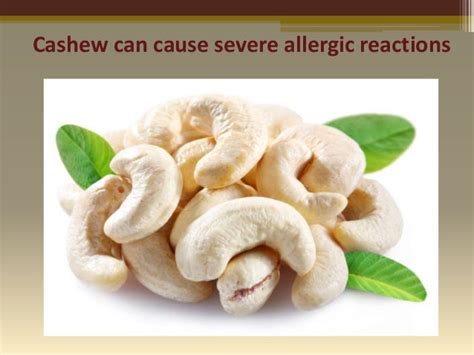 What Are The Symptoms Of Cashew Allergy