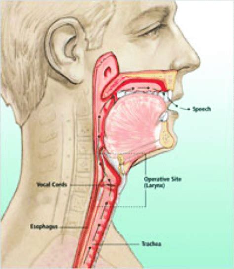 Anatomy And Physiology Of A Healthy Larynx Image Courtesy Of Inhealth