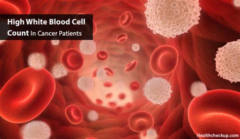 High White Blood Cells Count In Cancer Patients Cause Symptoms