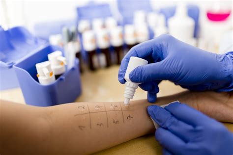 Why Allergy Testing Is Important For Your Health