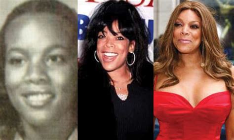 Wendy Williams Plastic Surgery Before And After Pictures 2021