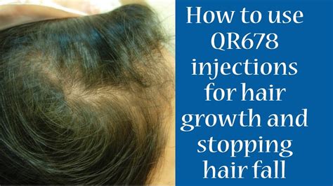 We are losing our hair due to nutritional / protein deficiencies not inflammation. How To Use QR 678 Injection for Hair Growth & Stopping ...