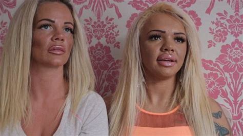 Mom And Daughter Spend Over 86 000 On Plastic Surgery End Up Looking Like This Photos Wise