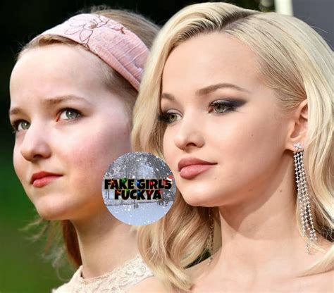 Dove Cameron Before And After Plastic Surgery Smartwatch Zb