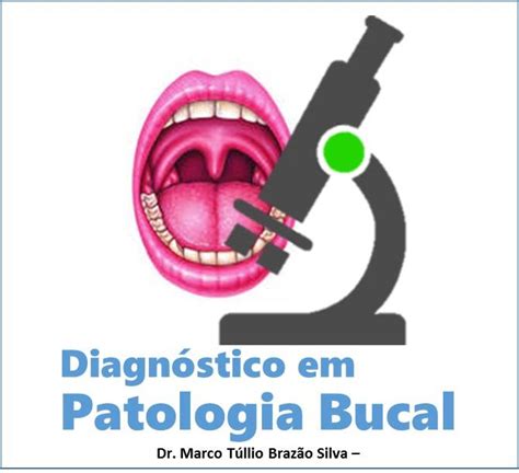diagnóstico em patologia bucal azala laboratório de patologia montes claros mg
