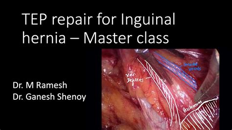 Tep Mesh Repair For Inguinal Hernia Masterclass Part 1 Youtube