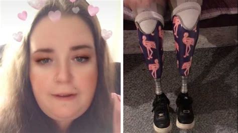 Mom Loses Both Legs During C Section And Trolls Say She Shouldve Kept