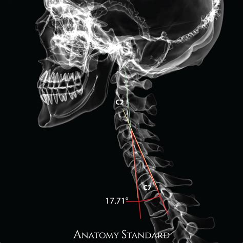 Sagittal Alignment Of The Spine
