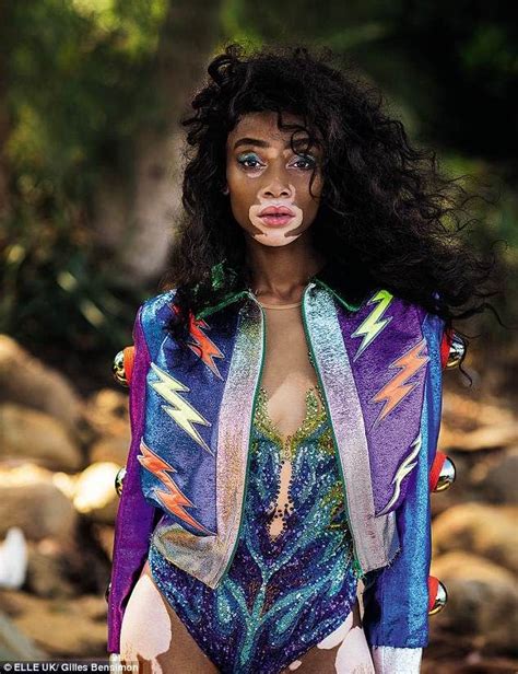 Winnie Harlow Prides Herself On Being Part Of The Shift With Beauty