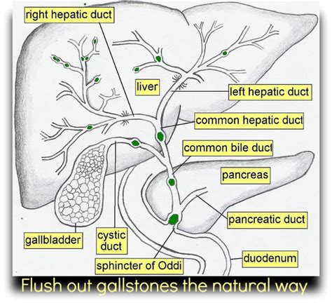 This subreddit is for people having gallbladder trouble, preparing for gallbladder removal, or a place to discuss. How To Flush Out Gallstones | HubPages
