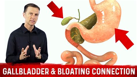Gallbladder And Bloating Connection Part 1 Drberg Bloated Stomach