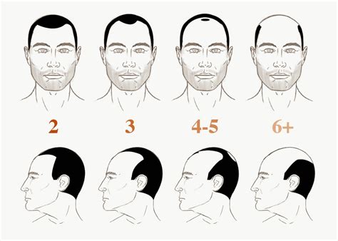 How Bald Are You ~ The Male Grooming Review