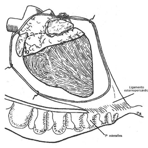 Anatomical Relationship Of The Fibrous Pericardium To The Sternum From