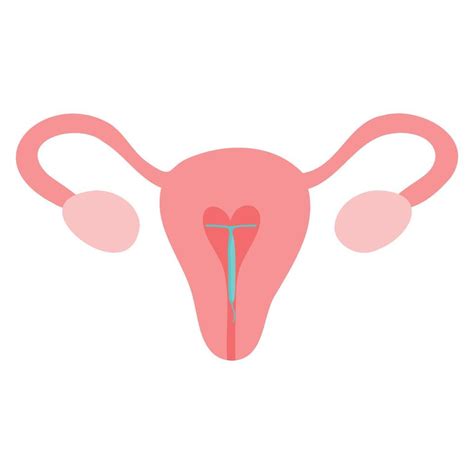 Hormonal Iud Copper Intrauterine Device Colored Flat Style Icon Women