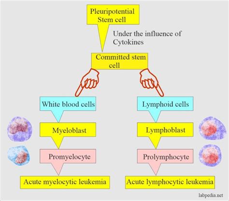 Acute Leukemias And Their Diagnosis Acute Myelocytic And Acute