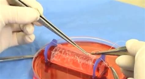 Lab Grown Vaginas Successfully Implanted In Girls The Doctor S Channel