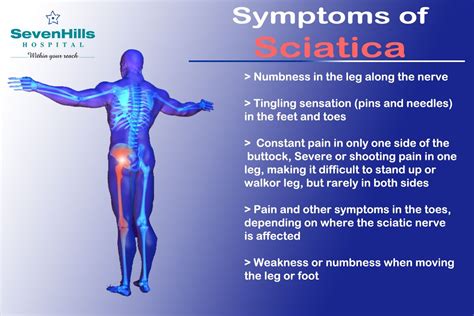 What Is Sciatica What Are The Symptoms Of Sciatica Images And Photos