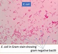 E. coli in gram stain: Introduction, Pathogenic strains and lab diagnosis