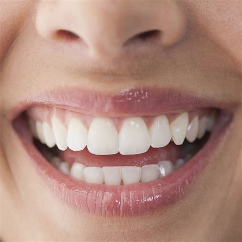 14 Tips From Dentists To Whitening Your Teeth Without Treatment Good