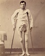 Portraits of Injured Civil War Soldiers - CVLT Nation