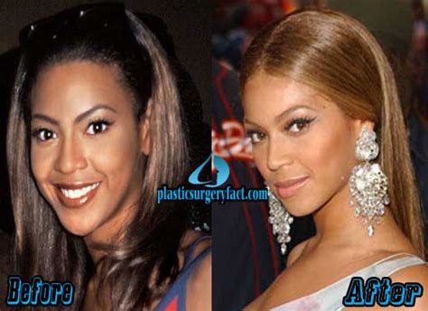 Beyonce Plastic Surgery Before And After Photos Plastic Surgery Facts
