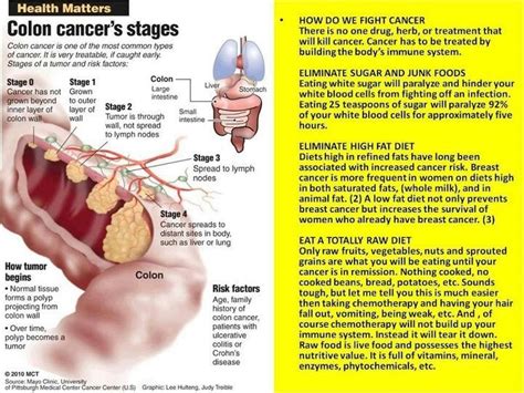 How Do You Know If You Have Stage 4 Colon Cancer