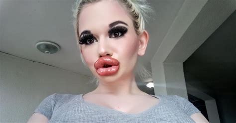 Woman With Biggest Lips In World Shows Off Huge New Pout After Th Injection Mirror Online