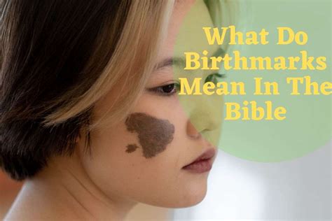 What Do Birthmarks Mean In The Bible 6 Important Meaning