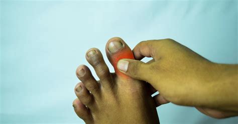 7 Common Causes Of Big Toe Pain