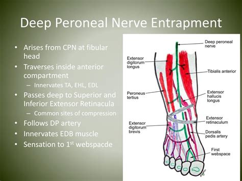 Deep Peroneal Nerve Injury