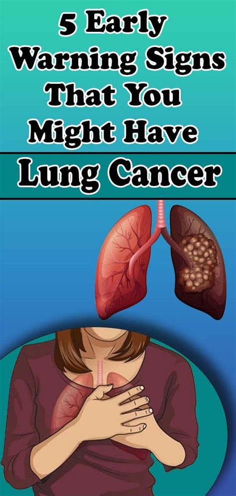 Lung Cancer Early Signs Reddit 10 Signs You May Have Lung Cancer