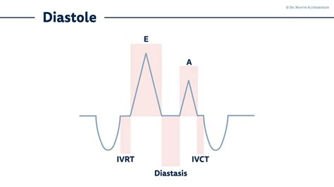 Echocardiography Diastolic Dysfunction II Time Intervals ECG