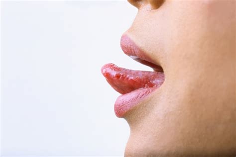 How To Remove Bumps On Tongue Livestrongcom