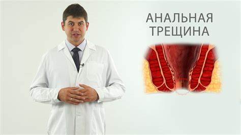 Диета после иссечения анальной трещины